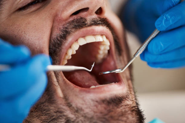 Best Knocked-Out Tooth Emergency  in Yutan, NE